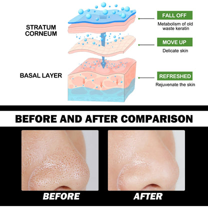 MASCARA REMOVEDORA DE CRAVO DE CARVÃO DE BAMBU