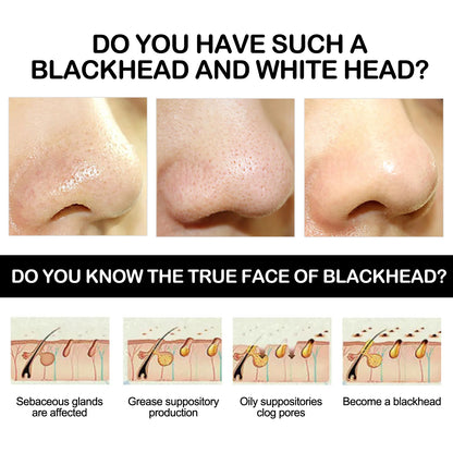 MASCARA REMOVEDORA DE CRAVO DE CARVÃO DE BAMBU